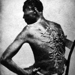 Scars From Slavery