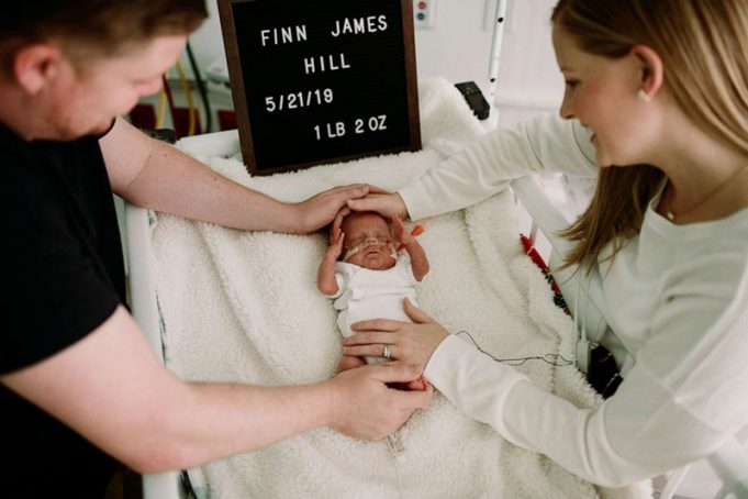 1-Pound Micro Preemie Who Fought 100 Days In NICU Heads Home After ...