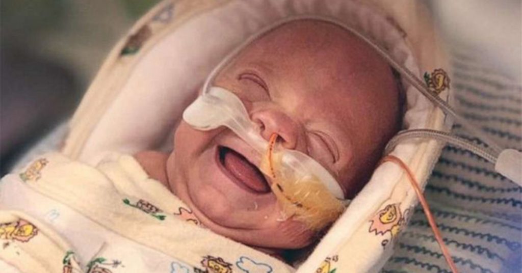 1-Pound Micro Preemie Who Fought 100 Days In NICU Heads Home After ...